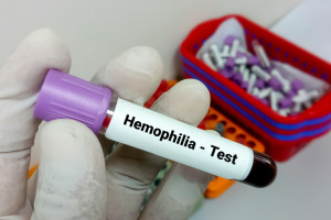 Hemofilia. W Polsce brakuje swobody w doborze terapii