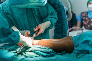 Implanty polskich naukowców mogą zrewolucjonizować ortopedię. Jest też szansa na trzecie zęby