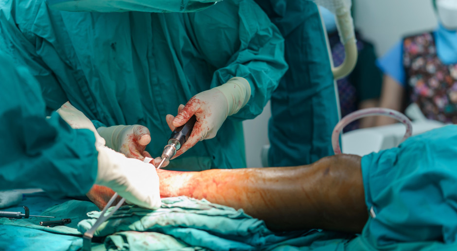 Implanty zespołu polskich naukowców mogą zrewolucjonizować ortopedię