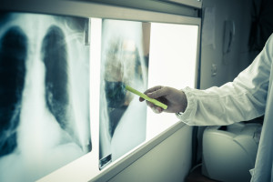Nowe poziomy referencyjne w rentgenodiagnostyce. Projekt w konsultacjach publicznych