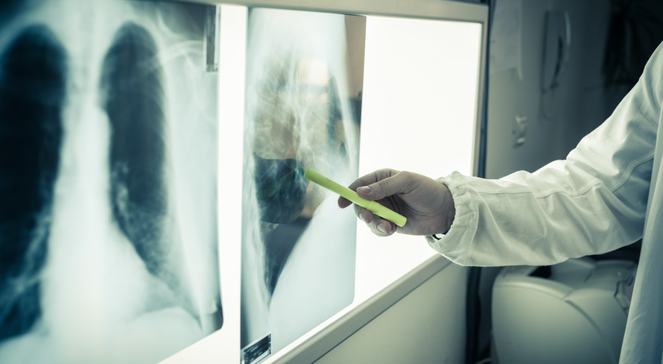 Nowe poziomy referencyjne w rentgenodiagnostyce. Projekt w konsultacjach publicznych