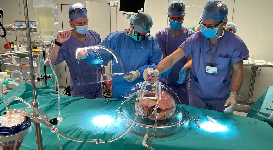 Specjaliści z Uniwersyteckiego Centrum Klinicznego po raz pierwszy przeprowadzili perfuzję płuc ex vivo. Fot. Łukasz Wojtkowicz/UCK Pierwsza perfuzja płuc ex vivo w Uniwersyteckim Centrum Klinicznym w Gdańsku