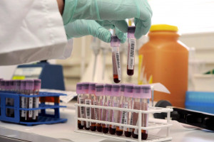 Hematolog: dostęp do leków ograniczających zużycie krwi jest potrzebny jak tlen