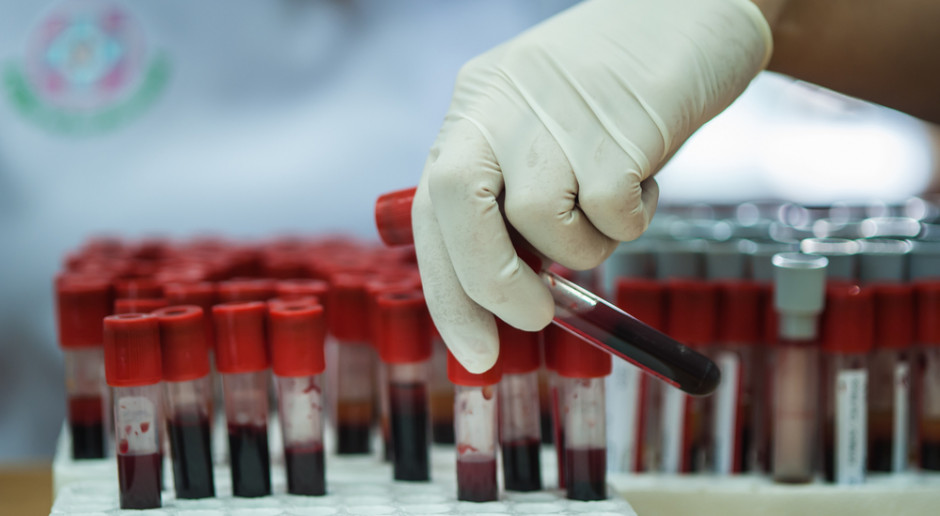 Przebieg COVID-19 a białka krwi. Ważną rolę odgrywa białko decydujące o grupie krwi