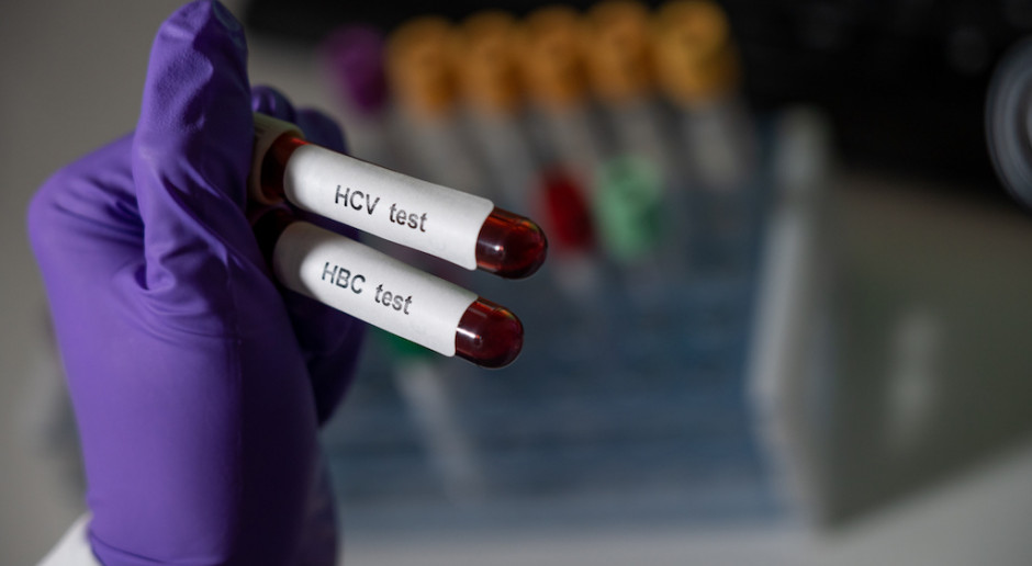 Zakażenia HCV wykrywajmy na możliwie wczesnym etapie. To ratuje pacjentom zdrowie i życie