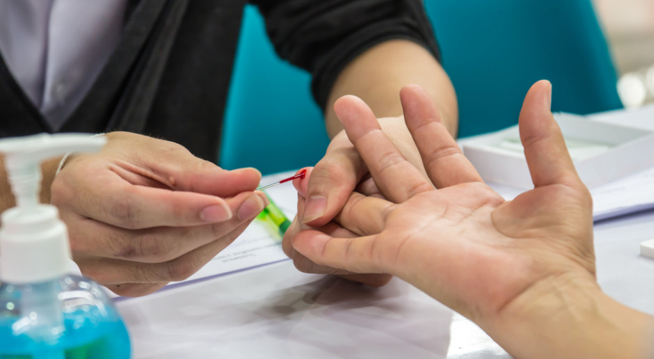 18 maja odbędzie się konferencja poświęcona zagadnieniom związanym z cholesterolem. Fot. Shutterstock 18 maja konferencja online „Zbyt wysoki cholesterol nie boli, ale zabija…”. NIPiP zaprasza