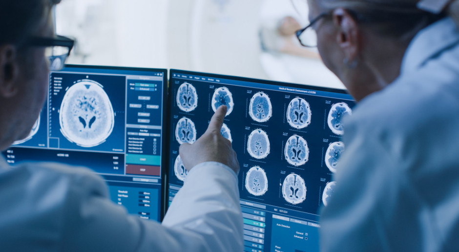 Agencja Badań Medycznych: w Polsce rozpoznawanych jest rocznie około 3 tys. nowotworów mózgu