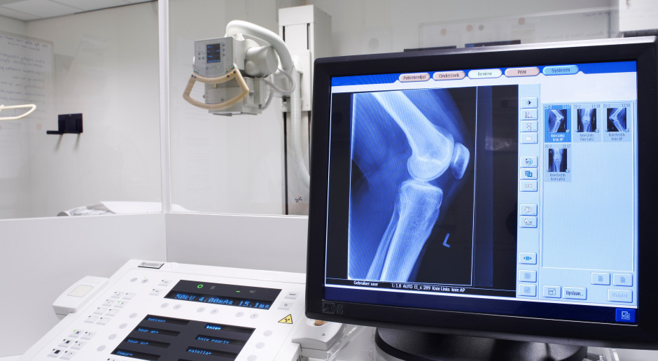 Pojawiła się konieczność ograniczenia dawek w rentgenodiagnostyce, radiologii zabiegowej i diagnostyce. Fot. Adobestock Tomograf, rentgen, mammografia, radioterapia i inne. Projekt ważnych przepisów o promieniowaniu