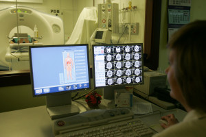 Sztuczna inteligencja sama postawi diagnozę i zapełni luki kadrowe wśród radiologów?