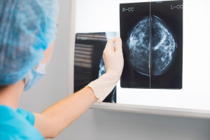 This diet lowers the risk of breast cancer.  There is one condition: