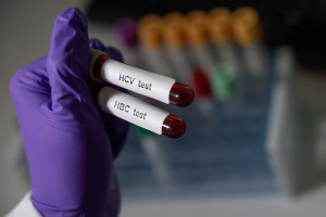 Przełom dla pacjentów: testy na HCV bezpłatnie w POZ. Będą dostępne już od 1 lipca