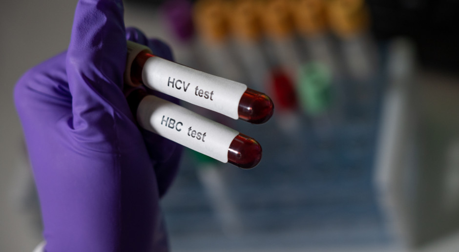 Przełom dla pacjentów: testy na HCV bezpłatnie w POZ. Będą dostępne już od 1 lipca