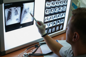Powstanie Regionalne Centrum Pulmonologii. 150 łóżek dla osób z chorobami układu oddechowego