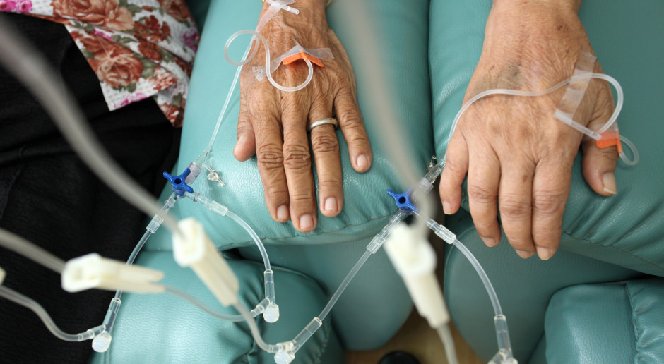 Naukowcy podzielili się wnioskami dotyczącymi chemioterapii. Fot. AdobeStock Chemioterapia raka piersi uszkadza naczynia krwionośne. Naukowcy odkryli mechanizm