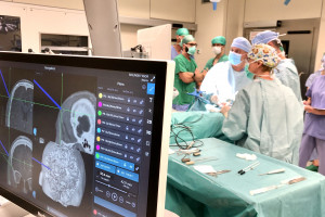 Ultranowoczesny robot po raz pierwszy w Polsce w asyście takiej operacji. Pacjentem nastolatek z padaczką