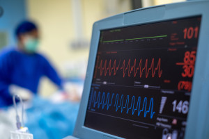 Szpital doposażony za ponad 14 mln zł. Kardiologia i interna zyskały nowe oblicze
