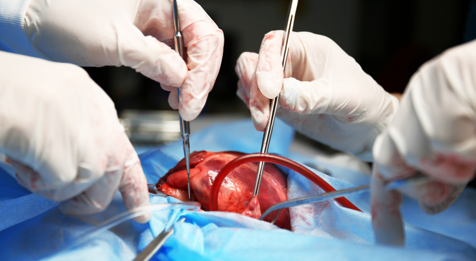 Kardiochirurdzy z WUM wszczepili sztuczną komorę serca nowej generacji
