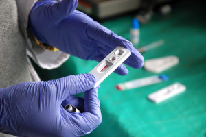 Nowoczesne leki na HIV są dostępne w Polsce. Przy skutecznym leczeniu chory nie stanowi zagrożenia