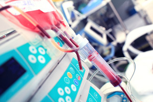 Ostra białaczka szpikowa: szpital przeprowadzi nowatorskie badania. Projekt wart 32 mln zł