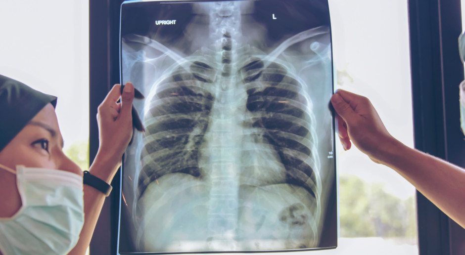 Przyczyną kaszlu i duszności może być POChP. Choruje 2 mln osób, większość o tym nie wie. Fot. Shutterstock Przyczyną kaszlu i duszności może być POChP. Choruje 2 mln osób, większość o tym nie wie