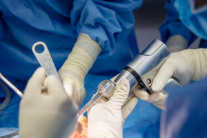 Endoprotezy kolana. Trzeci szpital w Polsce rozpoczął operacje innowacyjną metodą