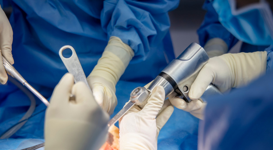 W Wejherowie takich zabiegów wykonano już kilka. Fot. Zdjęcie ilustracyjne Shutterstock Endoprotezy kolana. Trzeci szpital w Polsce rozpoczął operacje innowacyjną metodą