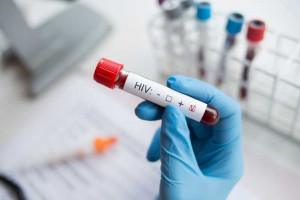 HIV/AIDS. Pacjenci boją się testować, żeby nie dowiedzieć się, że są zakażeni