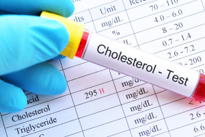 Wysoki poziom cholesterolu  a uwarunkowania genetyczne. Są już nowe i skuteczne leki