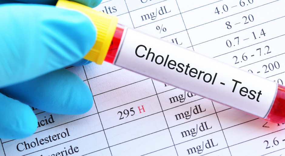 Dziedziczenie hipercholesterolemii dotyka nas coraz częściej. Fot. Adobestock Wysoki poziom cholesterolu a uwarunkowania genetyczne. Są już nowe i skuteczne leki