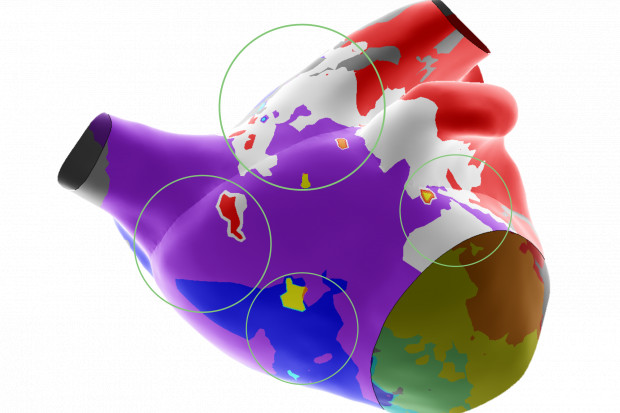 Mapa serca wykonana za pomocą systemu Ensite X.png