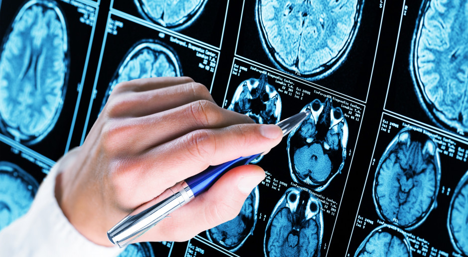 FDA zatwierdził nowy lek na chorobę Alzheimera