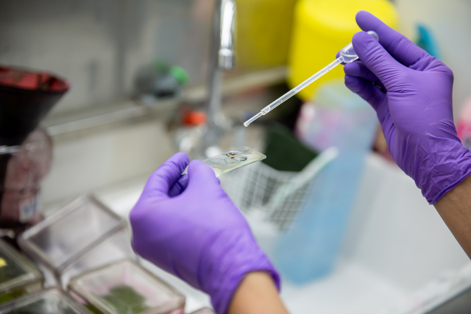 NFZ namawia do cytologii. Rak szyjki macicy jest 6. co do częstości występowania nowotworem u kobiet w Polsce