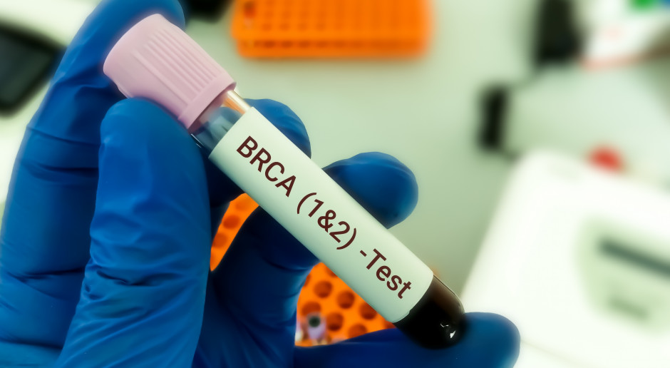 Rozpoczęły się badania kliniczne kobiet z mutacją w genach BRCA1 i BRCA2