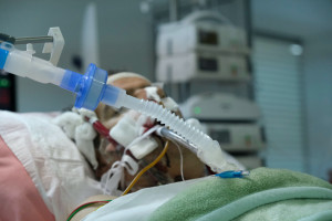 Jesteśmy otoczeni grzybami. Potrafią być groźne dla osób leżących w szpitalu