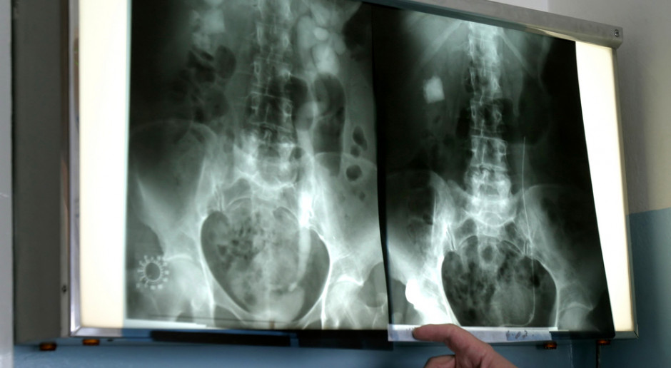 Prezes AOTMiT weryfikuje wycenę badania scyntygraficznego. Fot. Shutterstock Scyntygrafia: AOTMiT zbiera dane. Będzie weryfikować wycenę świadczeń