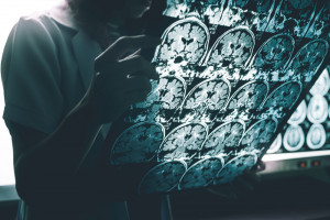 Techniki obrazowania w diagnostyce Alzheimera dają coraz lepsze wyniki
