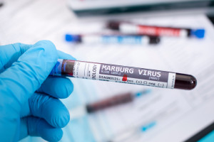 Ekspertka: wirus Marburg charakteryzuje się wysoką śmiertelnością, nawet do 90 procent