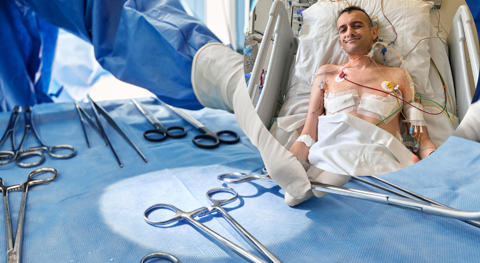 Lekarze ze SCCS wykonali drugie na świecie przeszczepienie płuc u pacjenta z zespołem Mounier-Kuhna