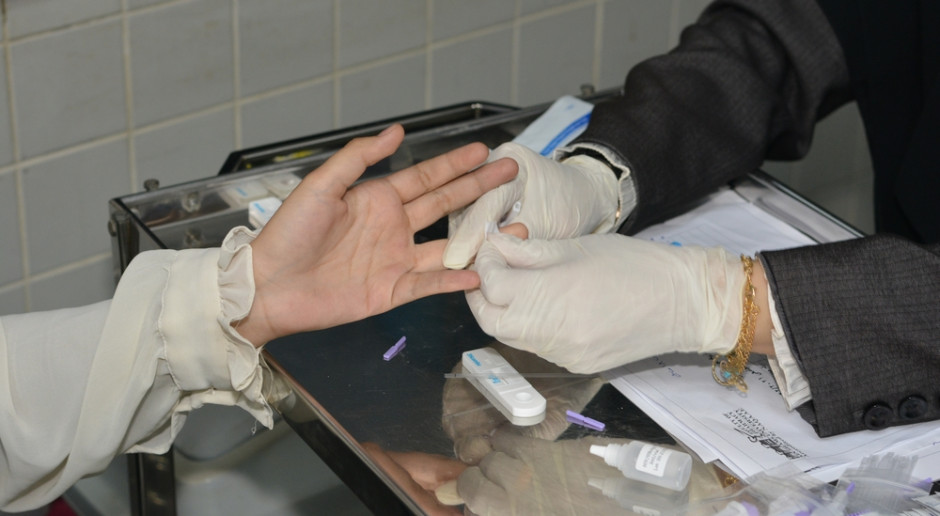 HCV. Prof. Flisiak: szybkie testy kasetkowe w POZ rozwiązałyby problem testowania