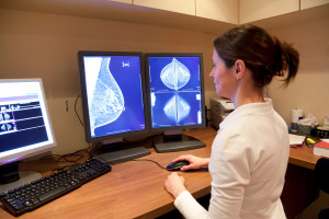 Rak piersi. Dr Streb: w raku potrójnie ujemnym należy zadbać o dostęp do terapii okołooperacyjnych