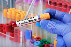 Hemofilia: AOTMiT opiniuje kolejny narodowy program leczenia. Rok 2023 będzie przełomowy?