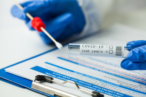 Dawcy już nie muszą wykonywać testów PCR na COVID-19. Rozporządzenie wchodzi w życie