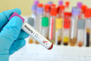 25 kwietnia: Światowy Dzień Walki z Malarią. Pierwszy kraj zatwierdził szczepionkę