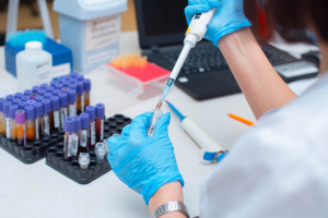 CeZ bada opinię diagnostów laboratoryjnych. Ankieta jest dostępna do 10 maja