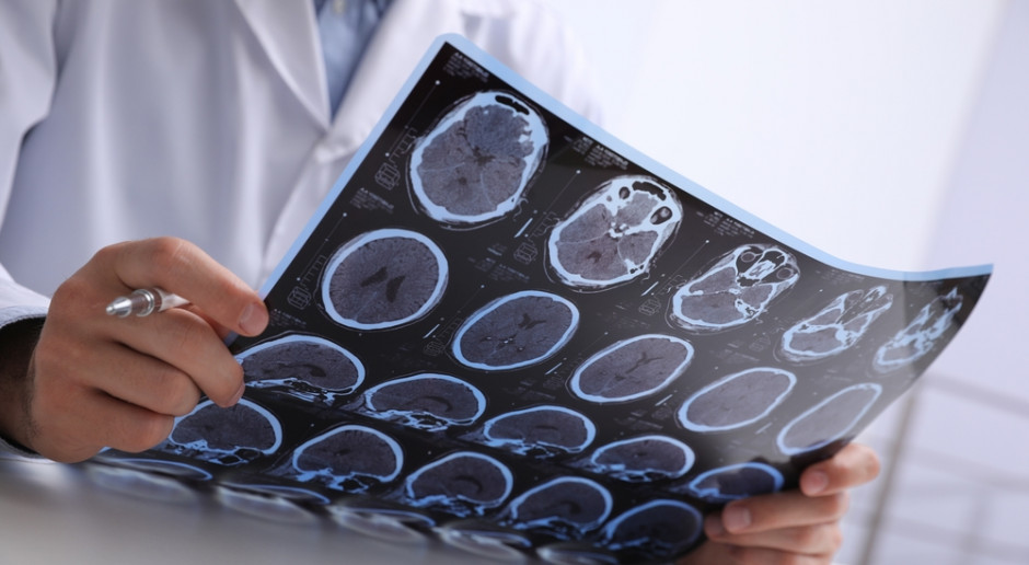 W nowym programie lekowym zwiększono dostępność leków dla pacjentów z różnymi postaciami SM. Fot. Shutterstock Dziś Światowy Dzień Stwardnienia Rozsianego. "Przełom w leczeniu SM to jeden z największych postępów w medycynie"