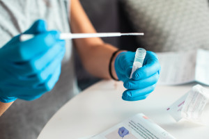 Polski test oceni ryzyko ciężkiego przebiegu infekcji COVID-19. Pierwszy taki na świecie