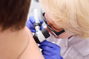 Ekspert o profilaktyce nowotworów skóry: każdy powinien raz w roku zbadać się u dermatologa