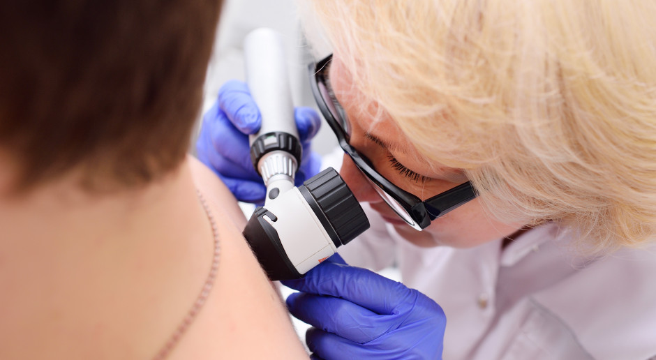 Ekspert o profilaktyce nowotworów skóry: każdy powinien raz w roku zbadać się u dermatologa