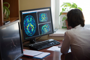 Neurologia dziedziną priorytetową. MZ: projekt nowelizacji jest już na końcowym etapie