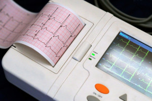 Lepsza diagnoza arytmii i zawałów serca. Naukowcy z PW wymyślili, jak udoskonalić EKG z użyciem sztucznej inteligencji
